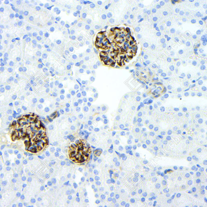 Immunohistochemistry analysis of Nestin. Sample: mouse kidney, 4% PFA 12-24h. Antigen retrieval: Citrate buffer, pressure cooker 2min. Primary antibody: 1:1000, 4C overnight. Secondary antibody: HRP conjugated Goat Anti-mouse lgG, 1:200, RT, 1h.