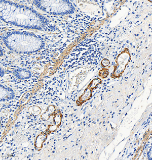 Immunohistochemistry analysis of smooth muscle Myosin heavy chain 11. Sample: Human colon, 4% PFA 12-24h. Antigen retrieval: Citrate buffer, pressure cooker 2min. Primary antibody: 1:1000, 4C overnight. Secondary antibody: HRP conjugated Goat Anti-Rabbit lgG, 1:200, RT, 1h.