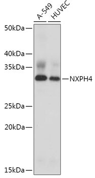 Western blot analysis of various lysates using NXPH4 Rabbit pAb (STJ11106448) at 1:1000 dilution. <br/>Secondary antibody: HRP-conjugated Goat anti-Rabbit IgG (H+L) (STJS000856) at 1:10000 dilution. <br/>Lysates/proteins: 25 Mu g per lane. <br/>Blocking buffer: 3% nonfat dry milk in TBST. <br/>Detection: ECL Basic Kit <br/>Exposure time: 10s.