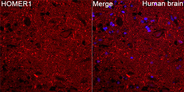 Immunofluorescence analysis of paraffin-embedded Human brain tissue using HOMER1 Rabbit pAb (STJ11107406) ata dilution of 1:200 (40x lens). Secondary antibody: Cy3-conjugated Goat anti-Rabbit IgG (H+L) (STJS001166) at 1:500 dilution.  Blue: DAPI for nuclear staining. Perform microwave antigen retrieval with 0. 01 M citrate buffer (pH 6. 0) prior to IF staining.