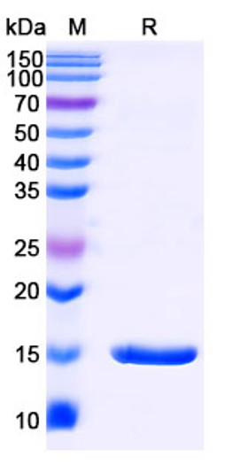 Anti-PTH nanobody [SAA1261] (STJN000078)