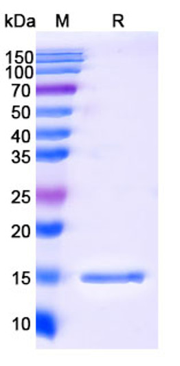 Anti-PIGR nanobody [SAA1311] (STJN000084)