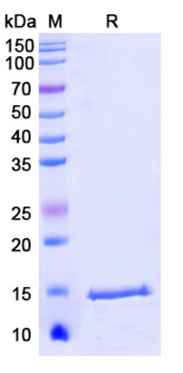 Anti-C6/Complement C6 nanobody [SAA1039] (STJN000148)