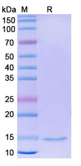 Anti-MMP12 nanobody [SAA1293] (STJN000213)