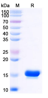 SDS-PAGE with Anti-ASC/TMS1/PYCARD Nanobody