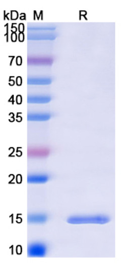 Anti-Sahara scorpion AaH II/Neurotoxin II nanobody [SAA2041] (STJN000547)