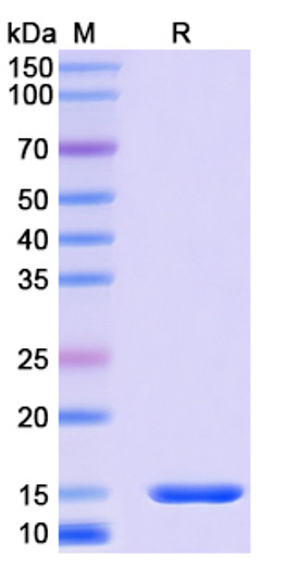 Anti-Human FOLR1 nanobody [SAA2048] (STJN000563)