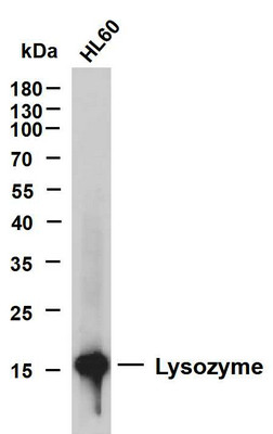 Western Blot (WB): HL60 whole cell lysates were separated by 12% SDS-PAGE, and the membrane was blotted with STJA0038882