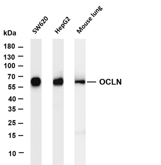 Western Blot (WB): Various whole cell lysates were separated by 4-20% SDS-PAGE, and the membrane was blotted with STJA0038890