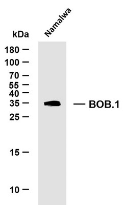 Western Blot (WB): Whole cell lysates were separated by 15% SDS-PAGE, and the membrane was blotted with anti-BOB.1 STJA0038902