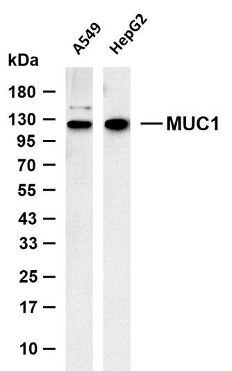 Western Blot (WB): Various whole cell lysates were separated by 4-20% SDS-PAGE, and the membrane was blotted with STJA0038905