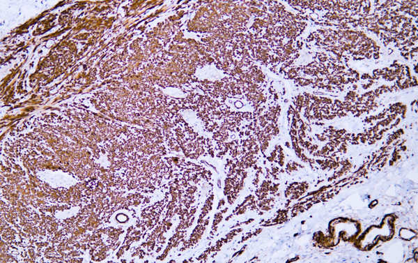 Immunohistochemistry - Paraffin (IHC-P): Human appendix tissue was stained with anti-caldesmon (ABT125) antibody. STJA0038908