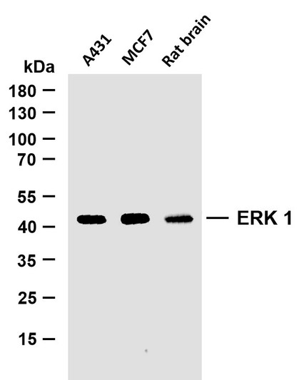 Western Blot (WB): Various whole cell lysates were separated by 10% SDS-PAGE, and the membrane was blotted with STJA0038911