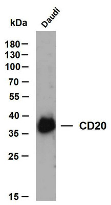 Western Blot (WB): Whole cell lysates were separated by 10% SDS-PAGE, and the membrane was blotted with anti-CD20 STJA0038921