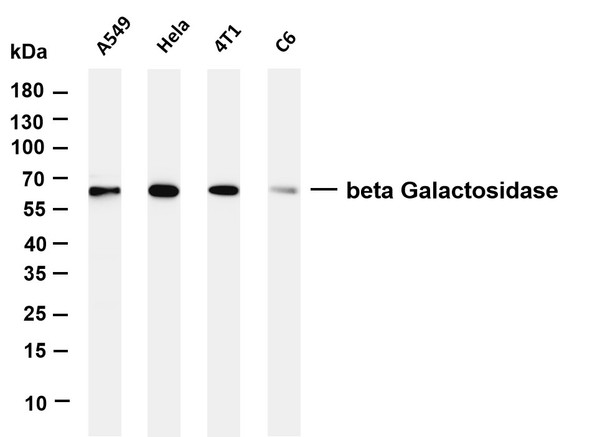 Western Blot (WB): Various whole cell lysates were separated by 4-20% SDS-PAGE, and the membrane was blotted with STJA0038935