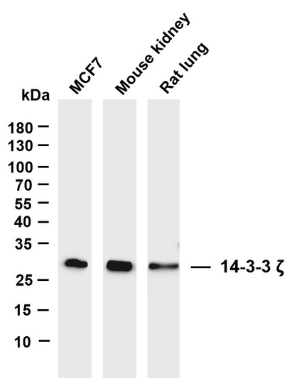 Western Blot (WB): Various whole cell lysates were separated by 4%-20% SDS-PAGE, and the membrane was blotted with STJA0038940