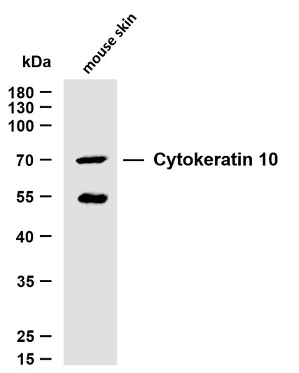 Western Blot (WB): Whole cell lysates were separated by 10% SDS-PAGE, and the membrane was blotted with STJA0038959