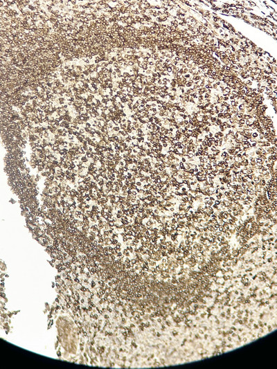 Immunohistochemistry - Paraffin (IHC-P): Human appendix tissue was stained with anti-CD74 (ABT202) antibody. STJA0038972