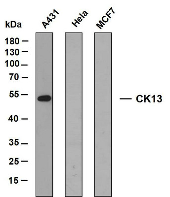Western Blot (WB): Various whole cell lysates were separated by 10% SDS-PAGE, and the membrane was blotted with STJA0038976