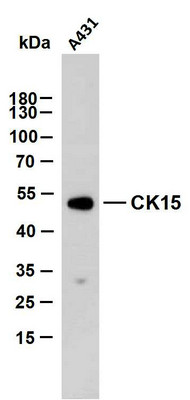 Western Blot (WB): A431 whole cell lysates were separated by 10% SDS-PAGE, and the membrane was blotted with anti-CK15 STJA0038977