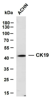 Western Blot (WB): ACHN whole cell lysates were separated by 10% SDS-PAGE, and the membrane was blotted with anti-CK19 STJA0038982