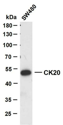Western Blot (WB): SW480 whole cell lysates were separated by 10% SDS-PAGE, and the membrane was blotted with anti-CK20 STJA0038983