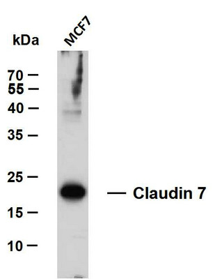 Western Blot (WB): MCF7 whole cell lysates were separated by 12% SDS-PAGE, and the membrane was blotted with STJA0038989
