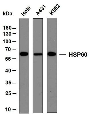 Western Blot (WB): Various whole cell lysates were separated by 10% SDS-PAGE, and the membrane was blotted with STJA0039008