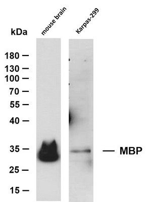 Western Blot (WB): Various whole cell lysates were separated by 10% SDS-PAGE, and the membrane was blotted with STJA0039012
