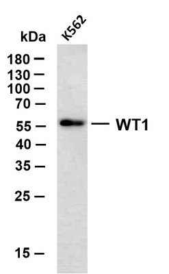 Western Blot (WB): K562 whole cell lysates were separated by 10% SDS-PAGE, and the membrane was blotted with anti-WT1 STJA0039032