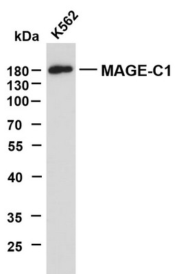 Western Blot (WB): K562 whole cell lysates were separated by 10% SDS-PAGE, and the membrane was blotted with STJA0039035