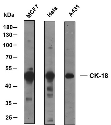 Western Blot (WB): Various whole cell lysates were separated by 10% SDS-PAGE, and the membrane was blotted with STJA0039052
