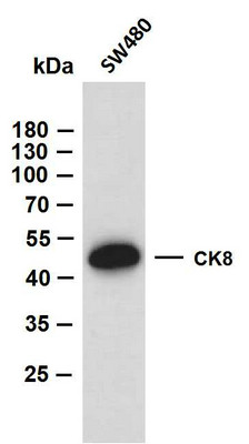 Western Blot (WB): SW480 whole cell lysates were separated by 10% SDS-PAGE, and the membrane was blotted with anti-CK8 STJA0039059