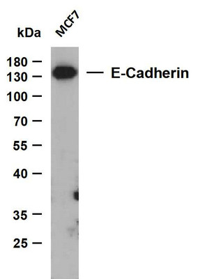 Western Blot (WB): Whole cell lysates were separated by 15% SDS-PAGE, and the membrane was blotted with anti-E-cadherin STJA0039062