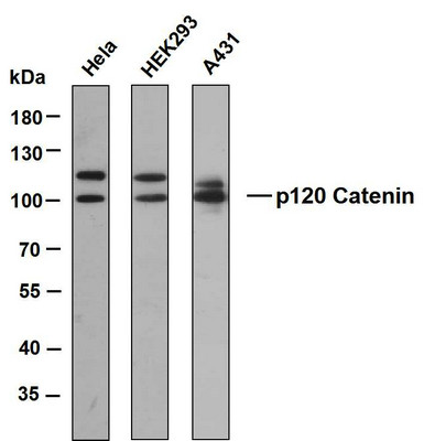 Western Blot (WB): Various whole cell lysates were separated by 8% SDS-PAGE, and the membrane was blotted with STJA0039069