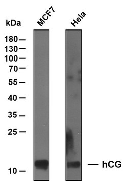 Western Blot (WB): Various whole cell lysates were separated by 12% SDS-PAGE, and the membrane was blotted with STJA0039089