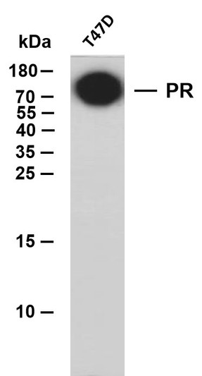 Western Blot (WB): Whole cell lysates were separated by 15% SDS-PAGE, and the membrane was blotted with anti-PR STJA0039095