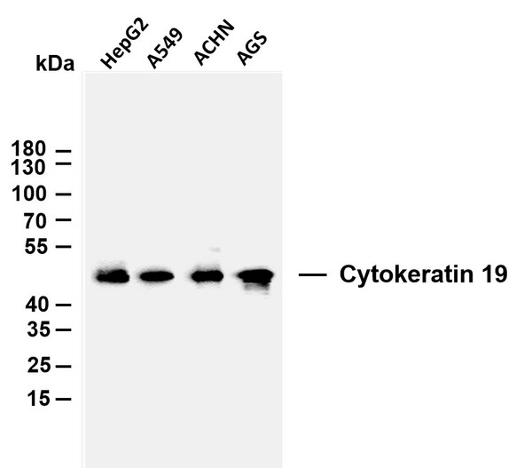 Western Blot (WB): Various whole cell lysates were separated by 10% SDS-PAGE, and the membrane was blotted with STJA0039118