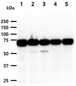 Western blot of human NSD3 antibody STJA0041522 across multiple cell lines