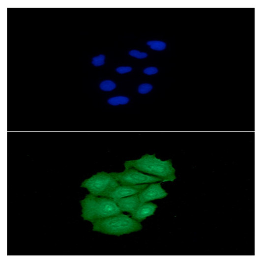 ICC IF of PEDFR PNPLA2 ATGL in Hep3B cells with Alexa Fluor 488 and DAPI staining