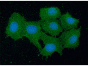 ICC IF of PRDX5 in Hep3B cells with DAPI and Alexa Fluor 488 staining