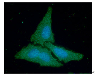 ICC IF of CKB in HeLa cells with DAPI nuclear staining and Alexa Fluor 488 detection