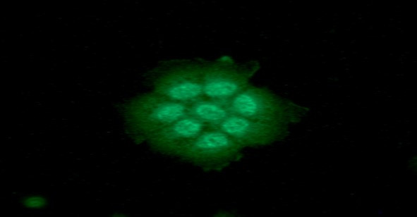 ICC IF of CTGF in Hep3B cells with STJA0041841 antibody Alexa Fluor 488 secondary green DAPI nuclear stain blue