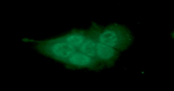 ICC IF of MCM7 in MCF7 cells stained with STJA0041854 antibody and Alexa Fluor 488