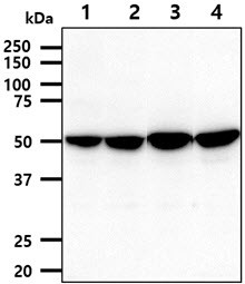 Western blot of human PDHX antibody STJA0041867 in A431 HepG2 293T and LnCap cell lysates