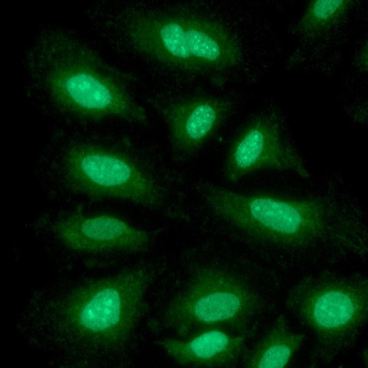 ICC IF of GCN5L2 in HeLa cells stained with KAT2A GCN5 antibody STJA0041900