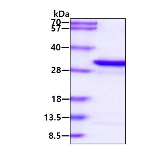 SDS-PAGE gel of recombinant human AK4 C22S protein under reducing conditions stained with Coomassie blue
