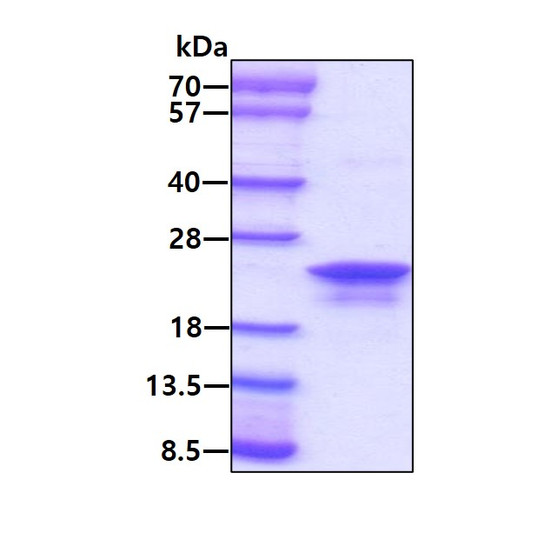 SDS-PAGE gel of recombinant human AG-2 AGR2 protein stained with Coomassie blue