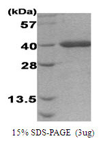 SDS-PAGE gel of recombinant human AHA1 protein under reducing conditions Coomassie blue stain