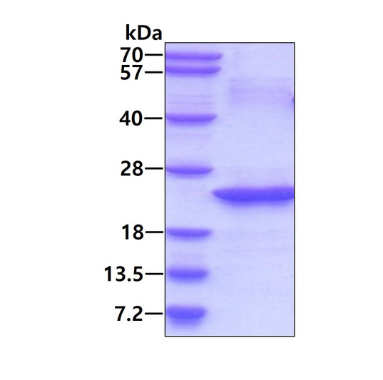 SDS-PAGE gel of recombinant human IL-32 protein stained with Coomassie blue